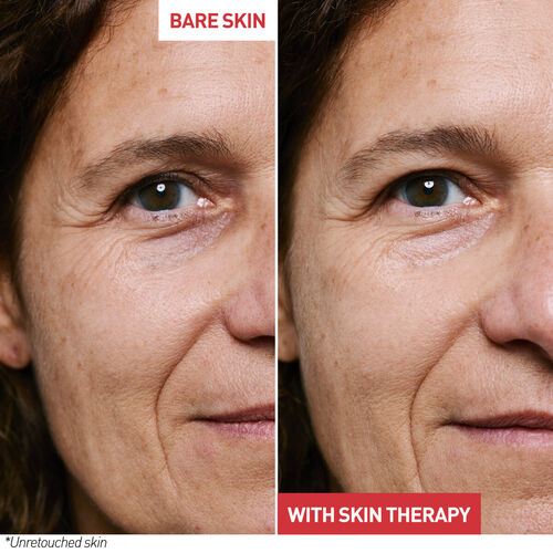 view 4/8 of Skin Therapy Milky-Serum, , GB
