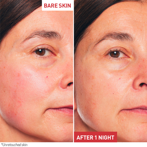 view 3/8 of Skin Therapy Oil-Serum, , GB