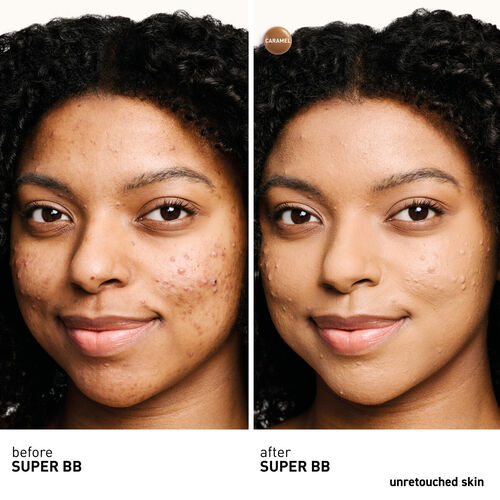 Super BB Caramel - full coverage BB cream for acne prone skin 15 ml (1) | Erborian